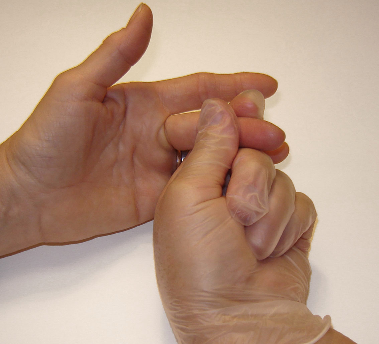 Bild som visar fingrets yttre led vid blodprovstagning