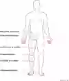 Anatomisk bild som visar benamputationsnivåer