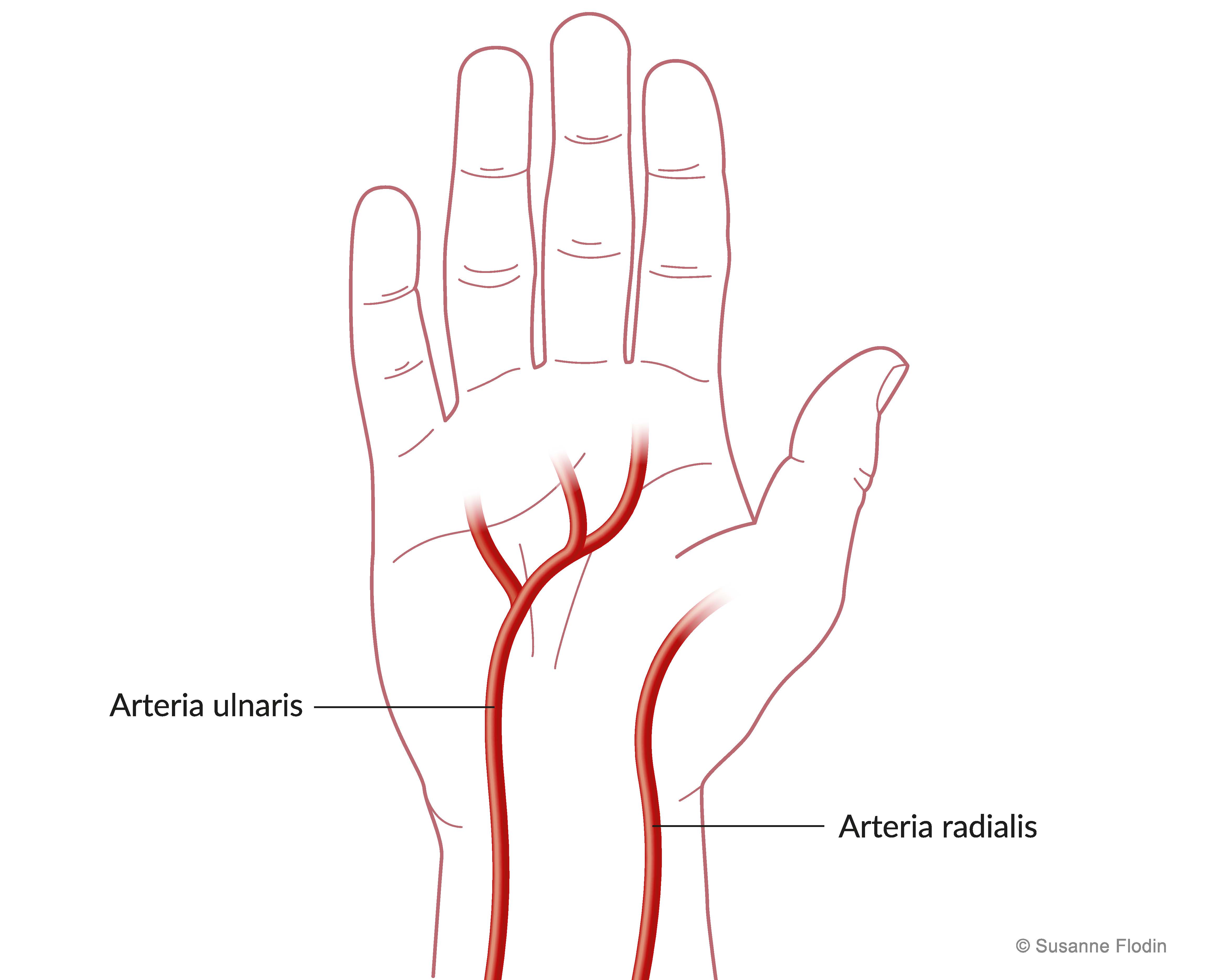 Bild som visar den anatomiska placeringen av handens artärer arteria radialis och arteria ulnaris.