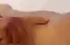 Bild som visar punktionsställe vid blododling
