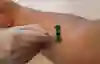 Bild som visar provtagning vid blododling