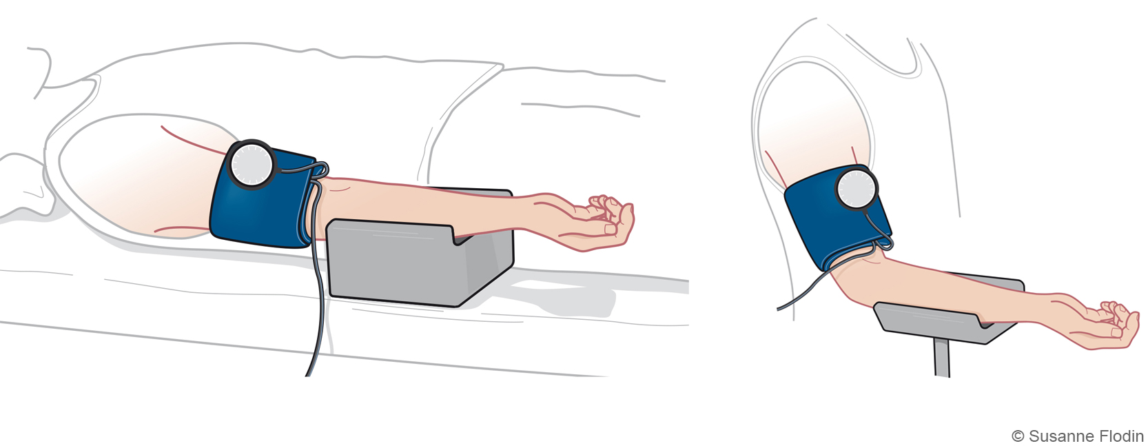 Bild som visar blodtrycksmätning liggande och sittande