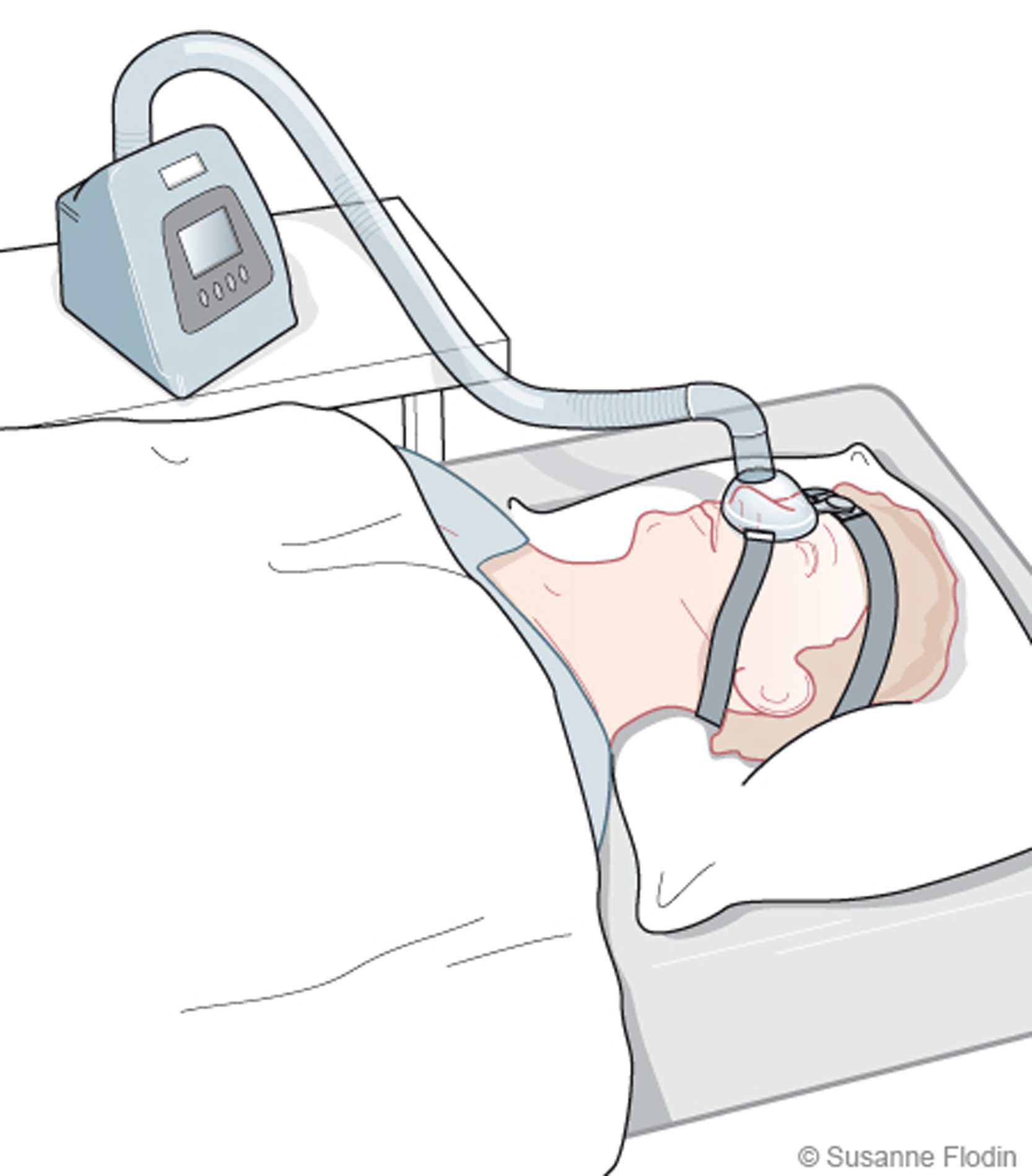 Bild som visar CPAP