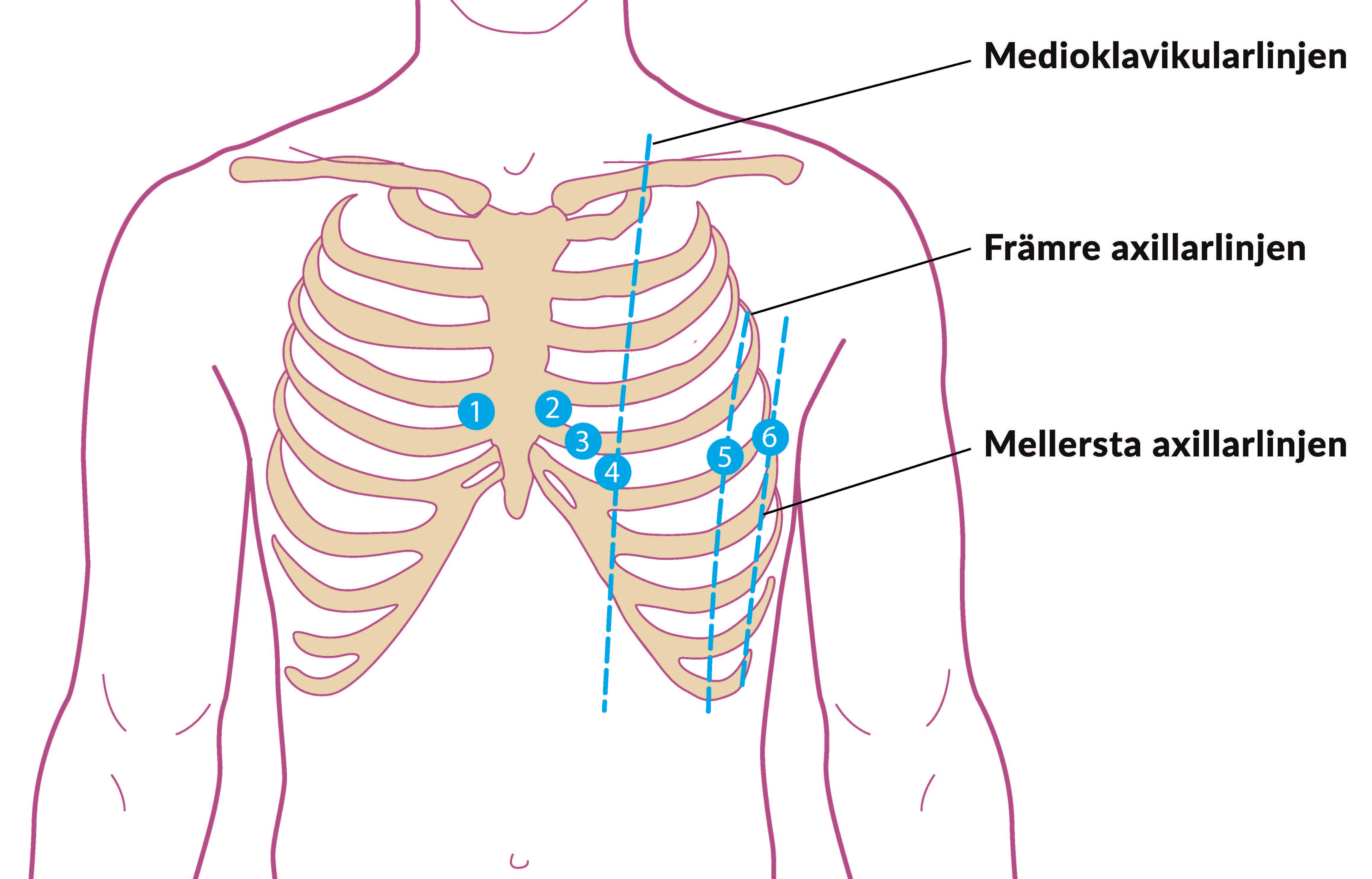 Visar var bröstavledningar ska placeras vid EKG