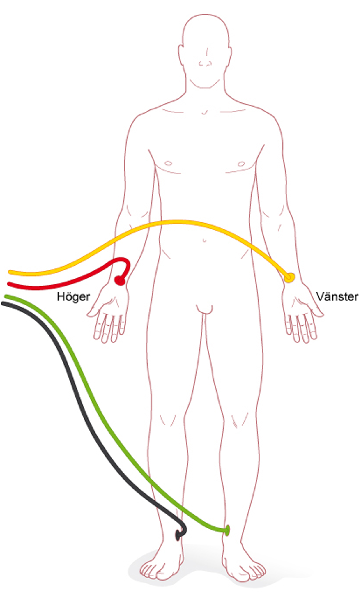 Bild som visar elektrodplacering vid EKG