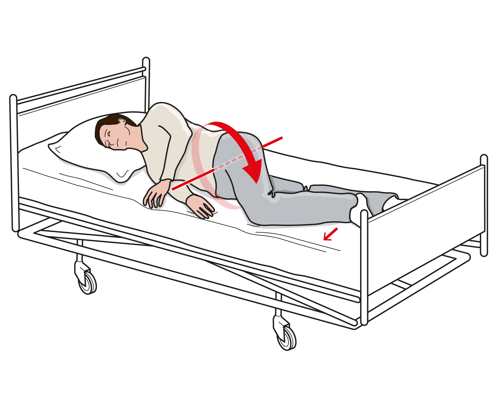 Illustration som visar person liggandes på sidan i sjukhussäng