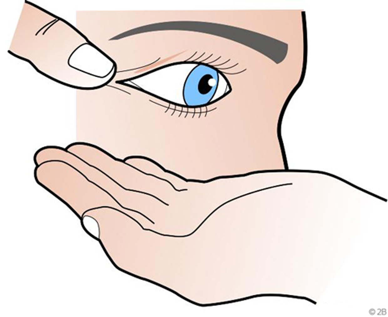 Bild som visar uttagning av hårda kontaktlinser