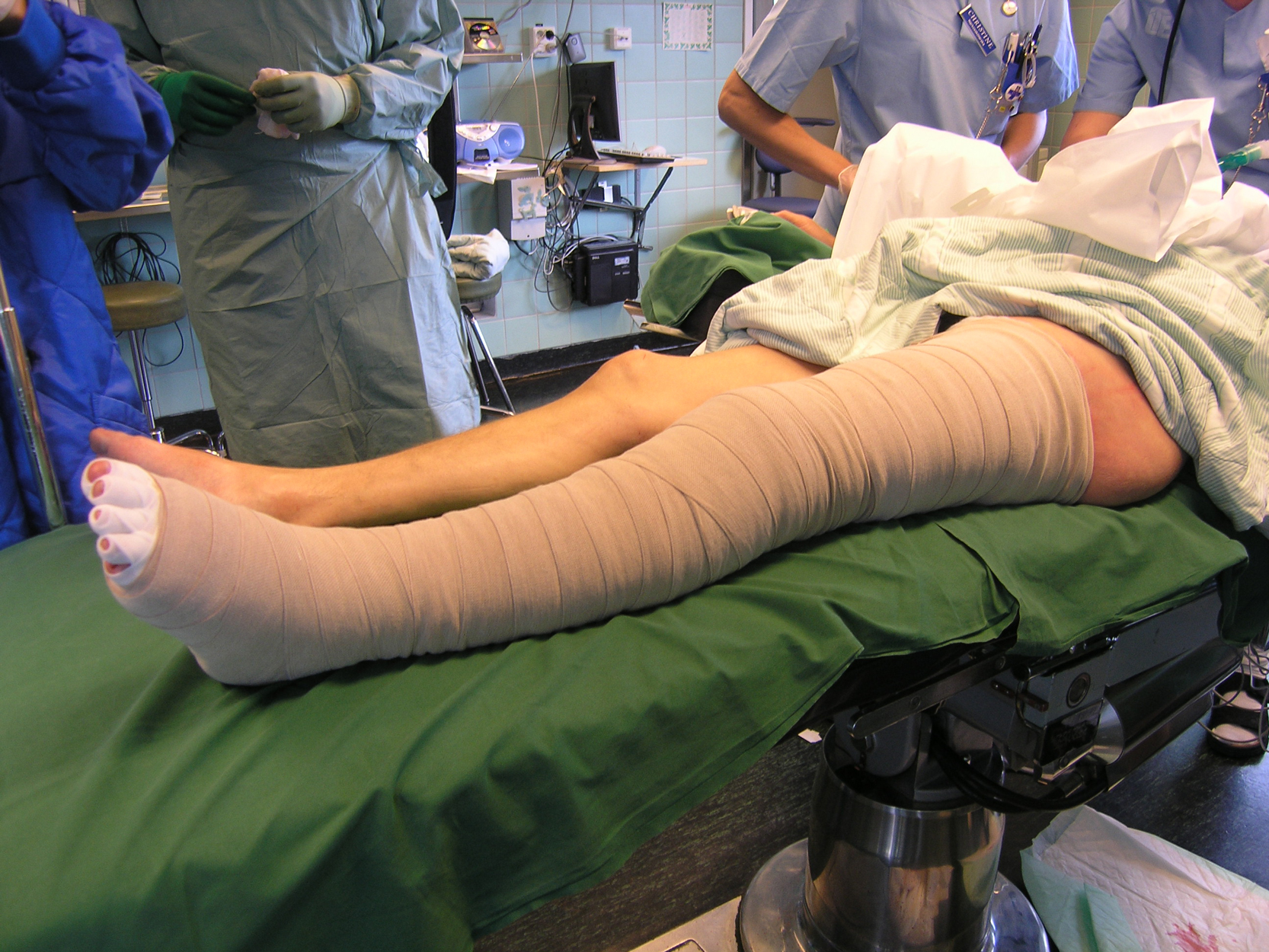 Bild som visar bandagering av ben efter avslutad fettsugning