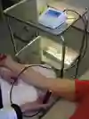Lokal vävnadsvätska kan mätas med TDC (Tissue Dielectric Constant) 