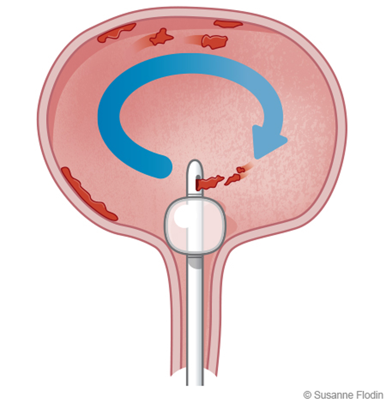 Qor ayollar porno Qanday qilib taglikdan kapot yasash mumkin