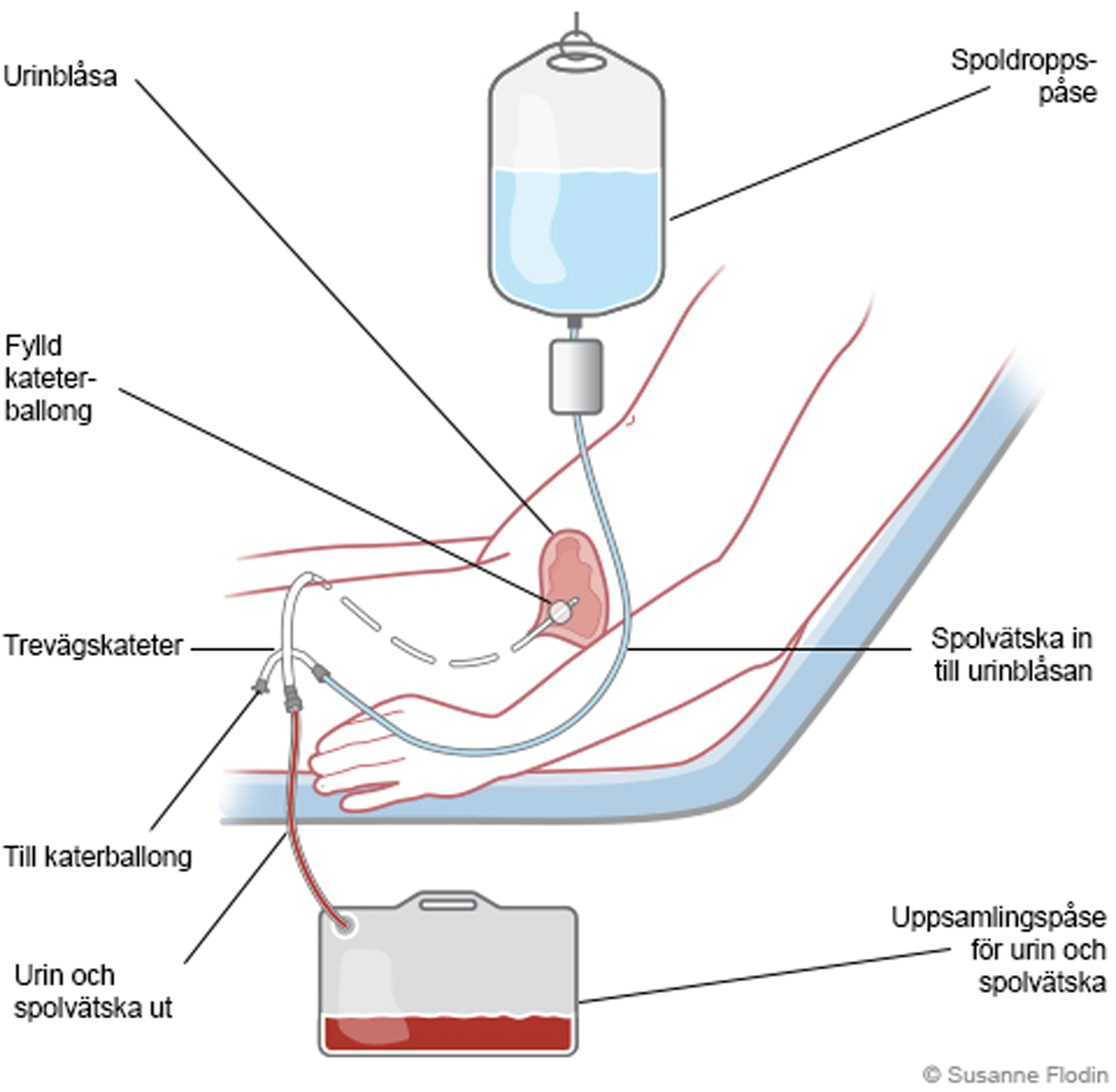 Porno porno jurnallarda Yalangoch, jingalak ayolning videosi