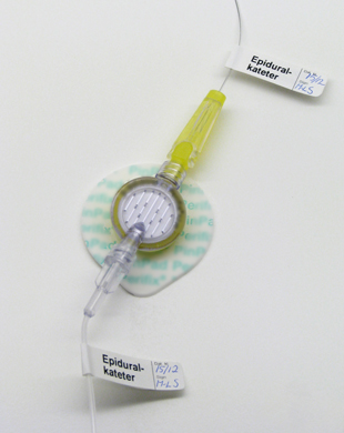 Bilden visar märkning av epiduralkateter