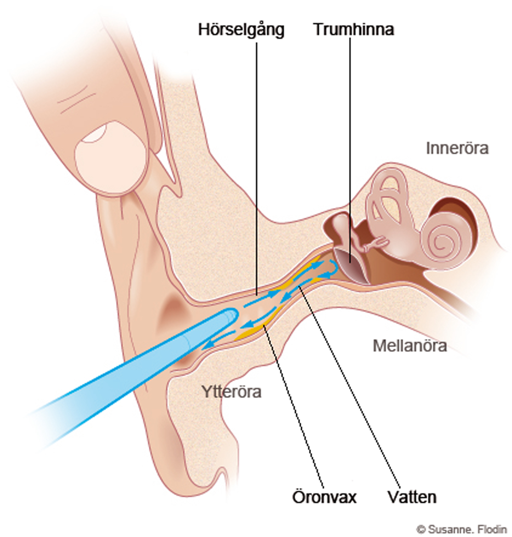 Hur man sprutar diagram