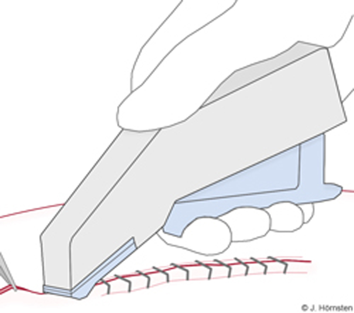 Bild som visar staplerteknik. 