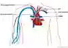 Anatomisk bild som visar subkutan venport