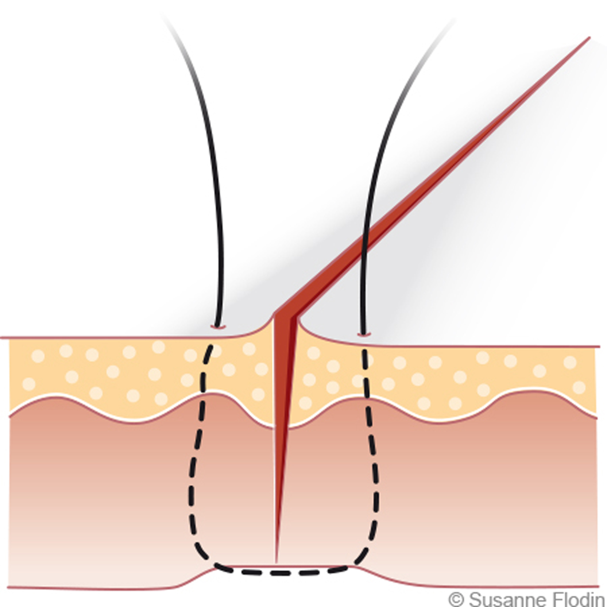 Quloq mmf porno Birodarlar porno filmida