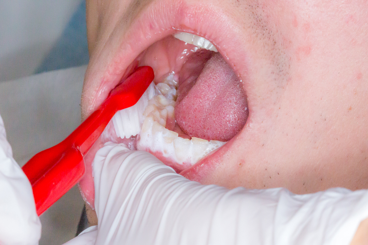Bild som visar tandborstning underkäke, till bildspel