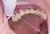 Bild som visar hur tandtråd används