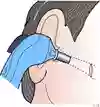 Bild som visar hur man får in probspetsen i hörselgången vid temperaturmätning. 