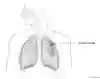 Lungorna i genomskärning som beskriver ett kompakt dränage och var det sitter på lungan.  