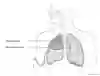 Thoraxdränage vid pneumothorax i genomskärning där de olika delarna namnges samt dränageplacering.