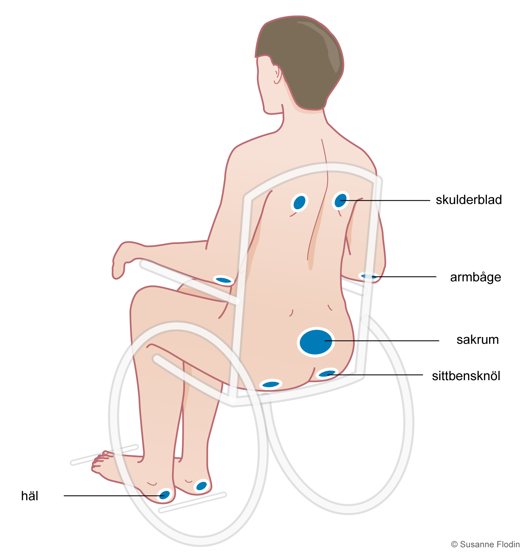 Bild som visar riskområden för trycksår vid sittande